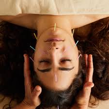 Cosmetic_Acupuncture