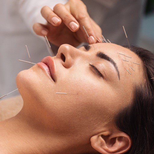 cosmetic acupuncture