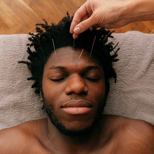 Facial Rejuvenation Acupuncture