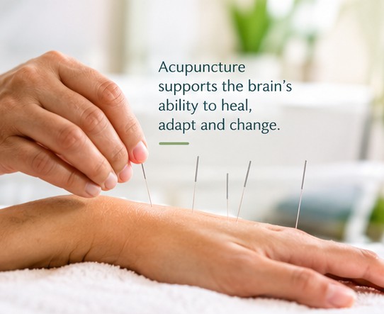 Acupuncture and brain neuroplasticity